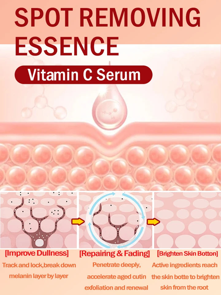 Lighten Freckles Melasma, Facial Dark Spots