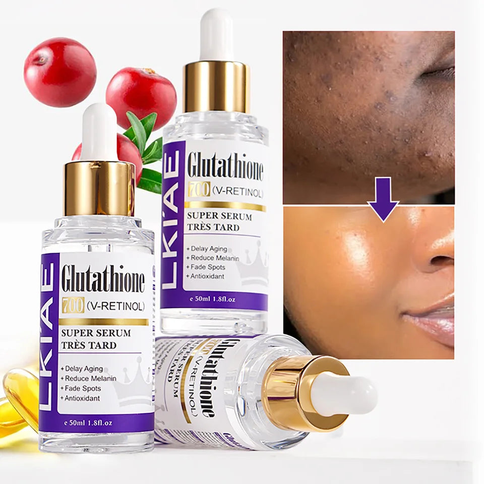 LKIAE Glutathione Whitening Face Serum, Remove Melanin, Dark Spots, Chloasma, With Retinol, Niacinamide, For All Skin Types